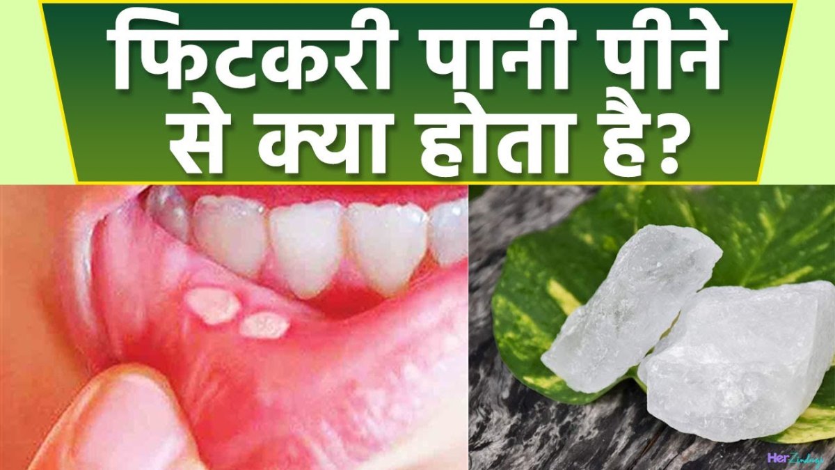 Fitkari Ke Kitne fayde aur Ghate kitne hote hain fitkari se bahut Sare bimariyan Dur Ho Jaati Hai 