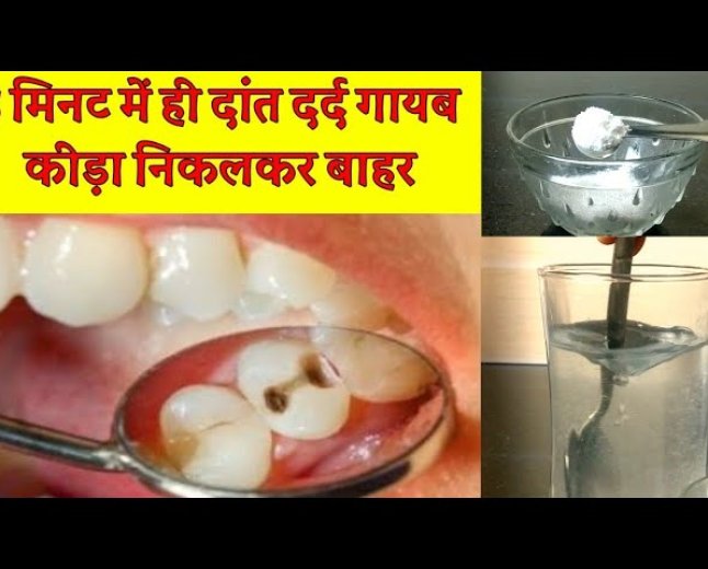 दात दर्द हो रहा है क्या करे यह उपाय जो फायदा है तो कोई बात नहीं है 