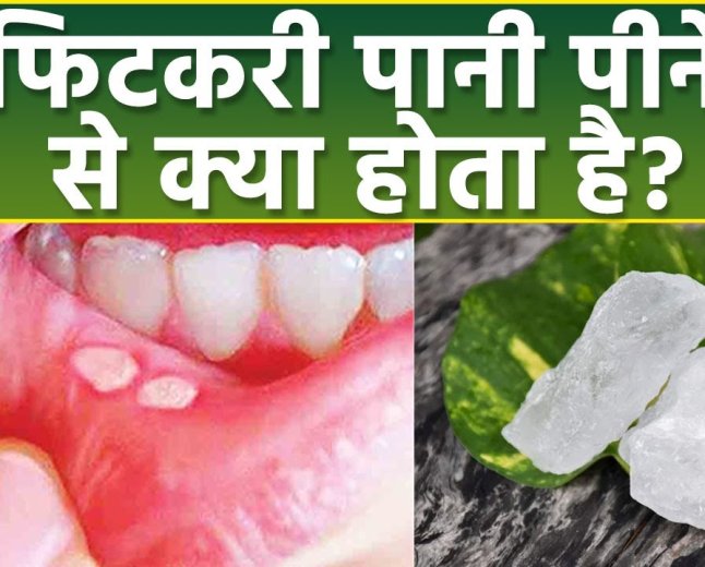Fitkari Ke Kitne fayde aur Ghate kitne hote hain fitkari se bahut Sare bimariyan Dur Ho Jaati Hai 